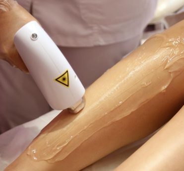 Laser Hair Removal Treatments 