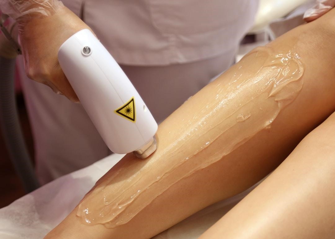 Laser Hair Removal Treatments 