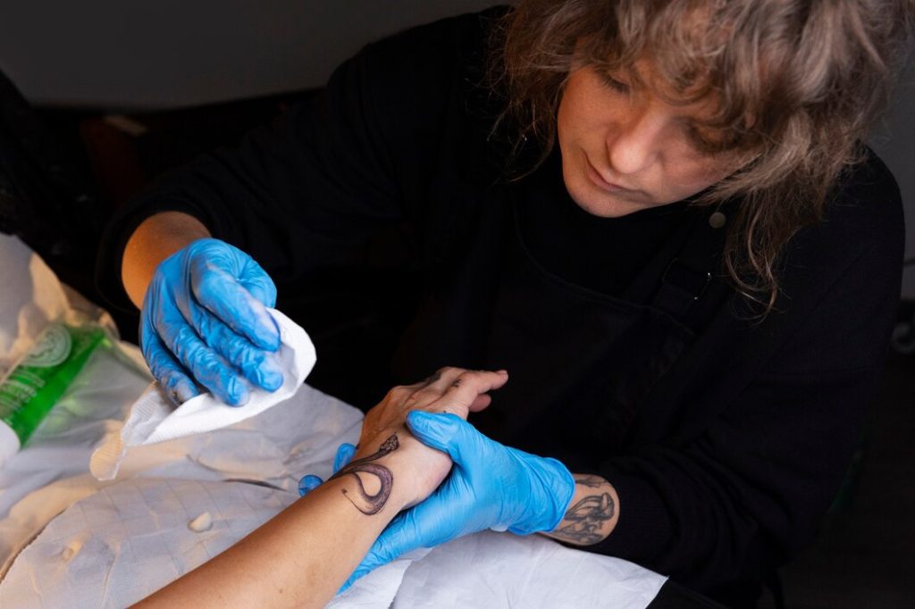 Exploring Tattoo Removal Options